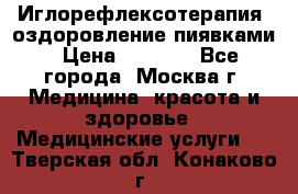 Иглорефлексотерапия, оздоровление пиявками › Цена ­ 3 000 - Все города, Москва г. Медицина, красота и здоровье » Медицинские услуги   . Тверская обл.,Конаково г.